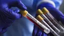 Italy flags two suspected Ebola cases in Milan linked to travel from Uganda
